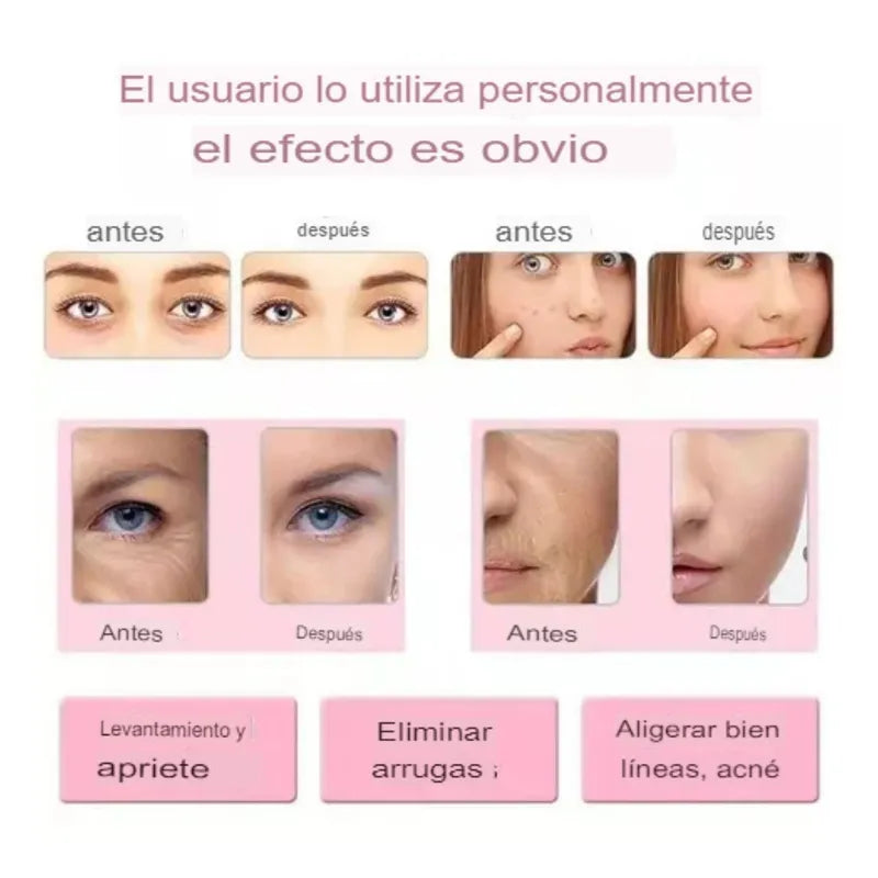 Masajeador Facial Ultrasónico